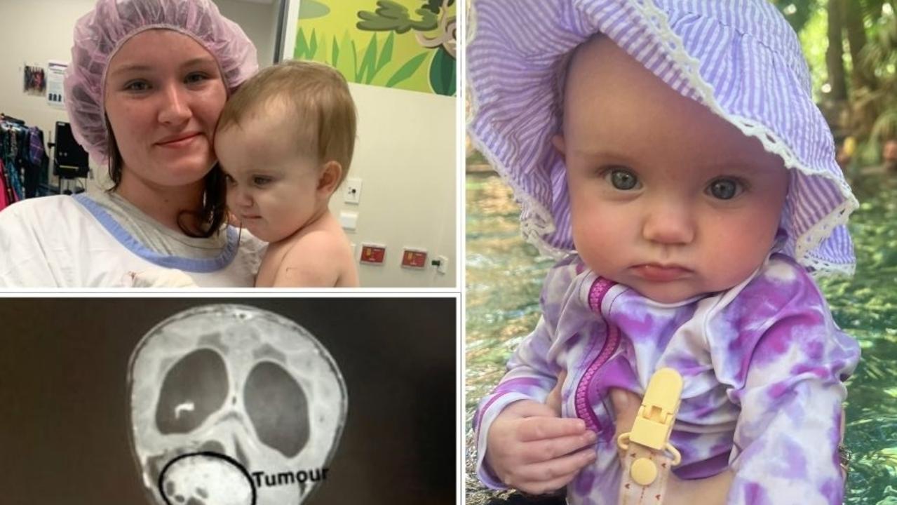 Lemon-sized tumour discovered in baby girl after ‘scary’ symptoms missed