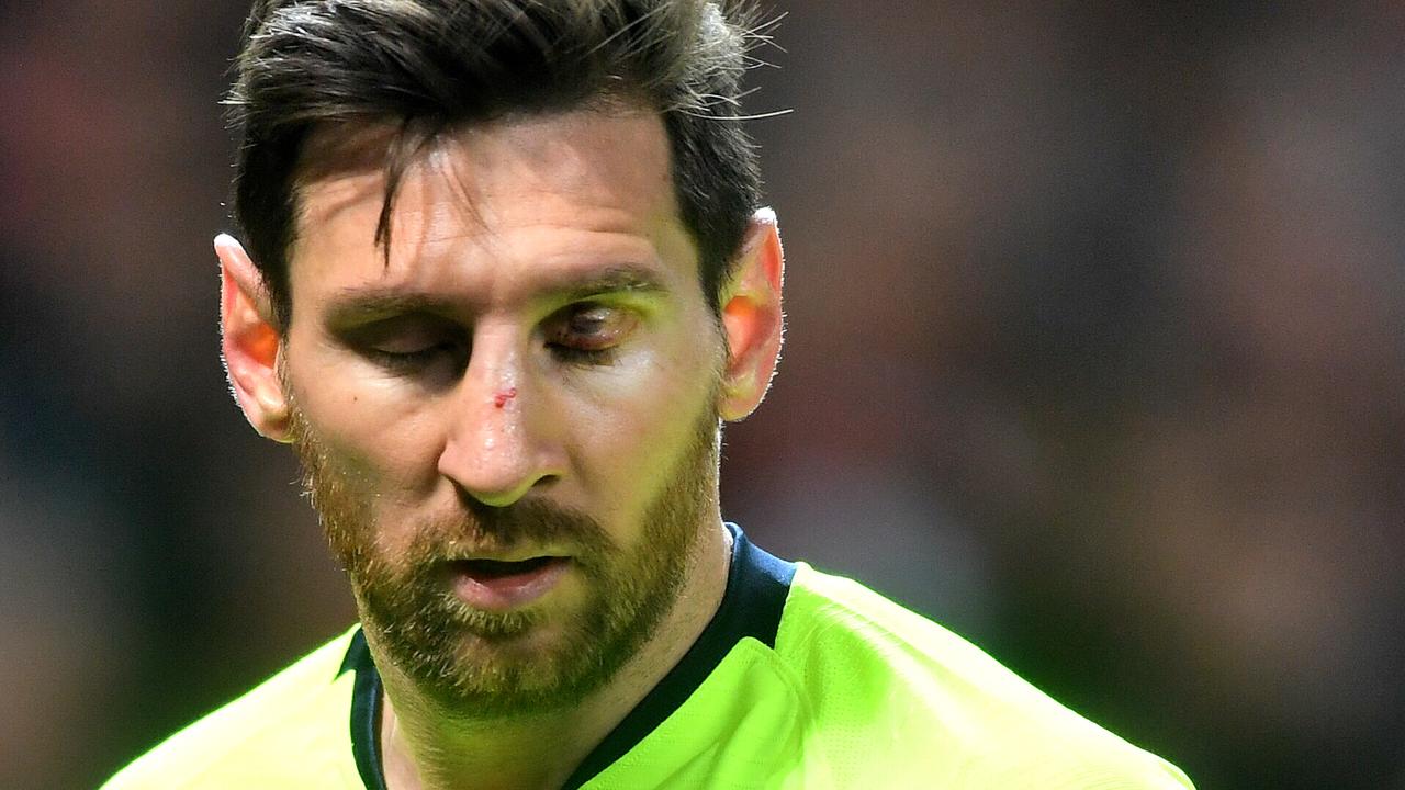 Lionel Messi was left bloodied by a challenge from Chris Smalling