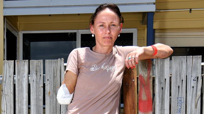 Garbutt resident Anne Marie Walters lost her arm in a gruesome dog attack. Picture: Evan Morgan