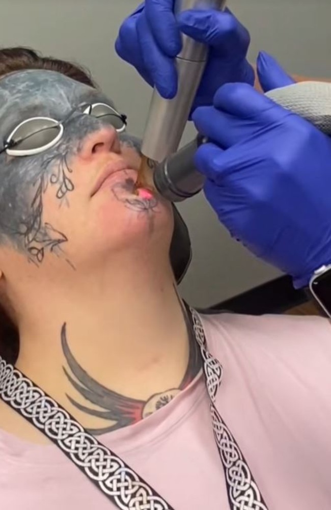 I got a full face tattoo against my will and can't get a job