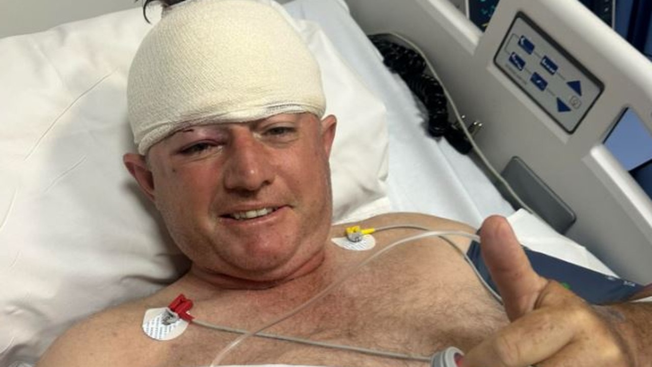 Guy Whittall in hospital after the attack.