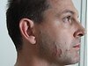 Gerard Baden-Clays cuts to face and body