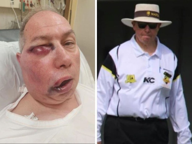 Umpire Tony de Nobrega and his injuries. Photos: Facebook