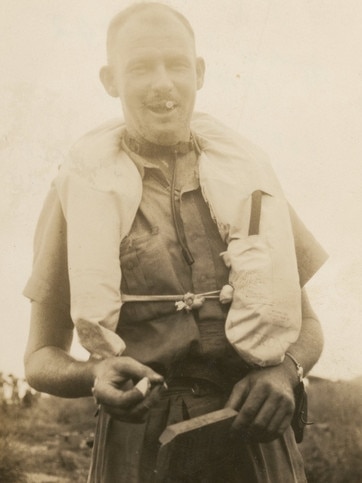 John Jackson nursing a bandaged finger after his ordeal in 1942. Picture: Australian War Memorial.