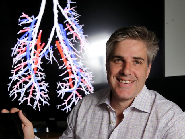 25/10/2016:  4DX founder Andreas Fouras, in Melbourne, has divised new software for imaging the lungs. Stuart McEvoy for The Australian.