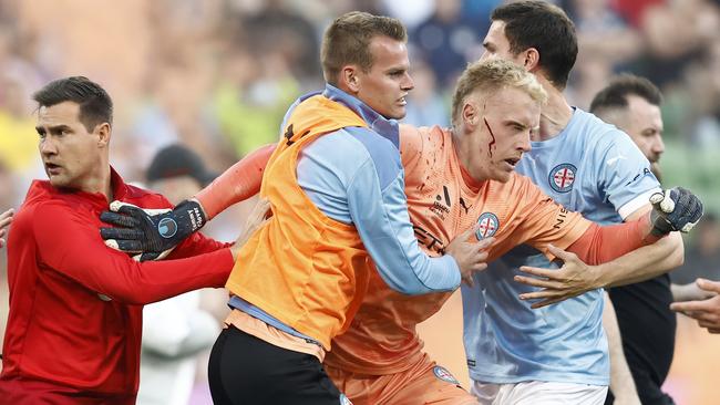 A bleeding Tom Glover of Melbourne City is escorted from the pitch by teammates after fans stormed the pitch at the Melbourne derby. (Photo by Darrian Traynor/Getty Images)