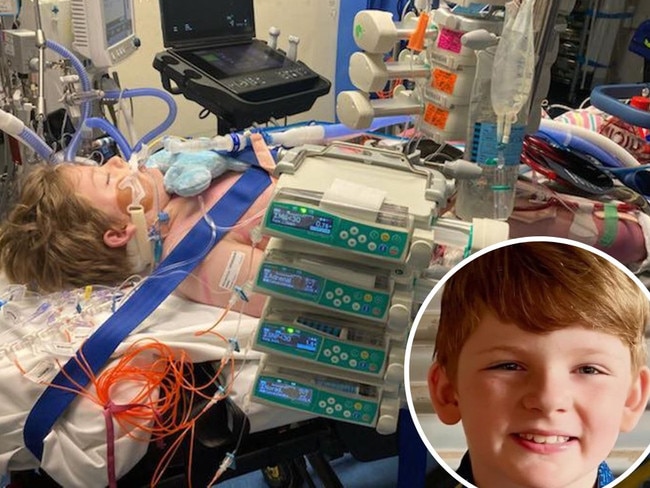 Maxwell Hann’s heart stopped beating on the operating table after the nine-year-old contracted the flu a few weeks ago.