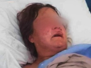 A woman has been hospitalised after a man attacked her with a wooden stake and knife. Picture: 9 News