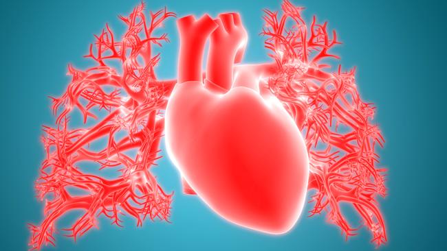 Risk of cardiovascular disease is usually calculated for populations, not individuals. Illustration: iStock