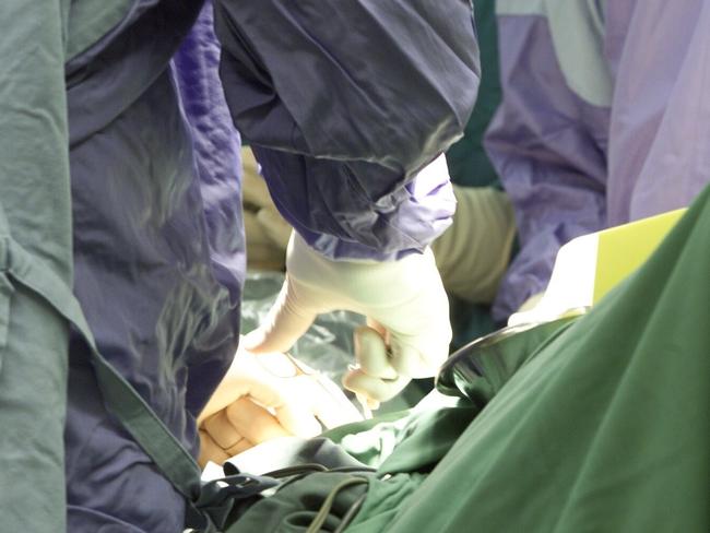 Surgeons perform an operation in the surgical room at Nambour Selangor hospital.Photo: Nicholas Falconer / Sunshine Coast Daily