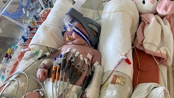 Two-week-old Pixie Doecke has had a host of health complications and is scheduled for heart surgery