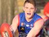 Star A-grade footballer ‘almost lost his life’ to burns