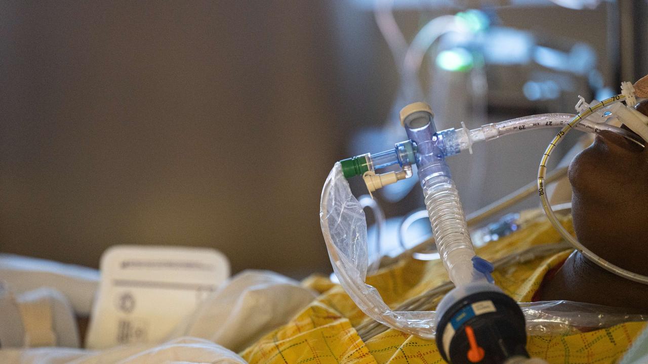 The mouth of a Covid-19 patient on a ventilator is seen in the ICU of Indiana’s Baptist Health Floyd. Picture: Jon Cherry/Getty Images/AFP