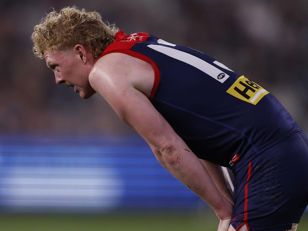 Clayton Oliver’s season is over. Picture: Darrian Traynor/AFL Photos/via Getty Images