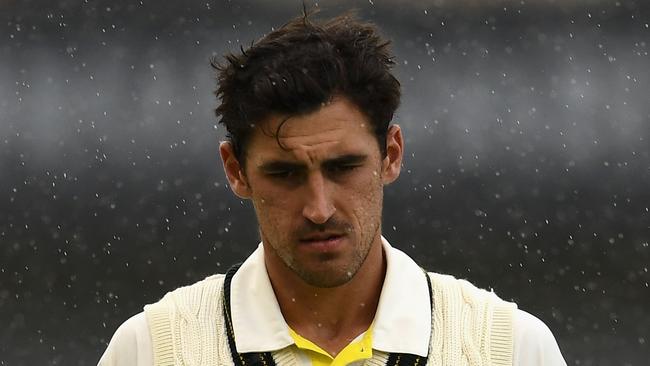 Mitchell Starc has suffered a bruised left heel.