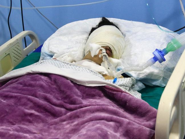 A child wounded during Israeli bombardment rests at a hospital in the southern Lebanese village of Saksaqiyeh on September 26, 2024. Israel flatly rejected on September 26 a push led by key backer the United States for a 21-day ceasefire in Lebanon, as it vowed to keep fighting Hezbollah militants "until victory". (Photo by Mahmoud ZAYYAT / AFP)