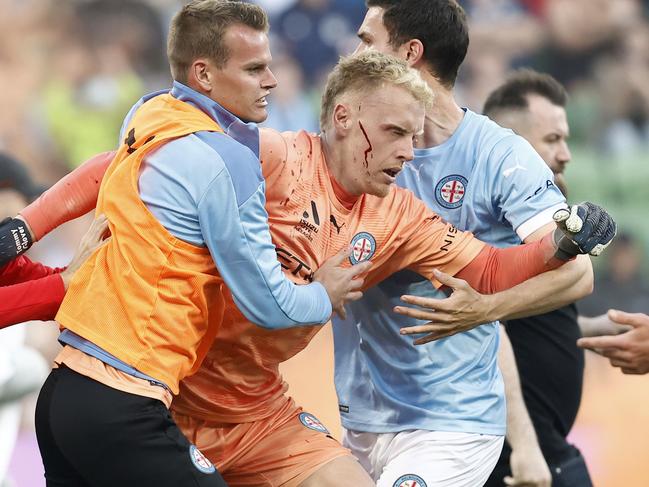 *APAC Sports Pictures of the Week - 2022, December 19* - MELBOURNE, AUSTRALIA - DECEMBER 17: A bleeding Tom Glover of Melbourne City is escorted from the pitch by team mates after fans stormed the pitch during the round eight A-League Men's match between Melbourne City and Melbourne Victory at AAMI Park, on December 17, 2022, in Melbourne, Australia. (Photo by Darrian Traynor/Getty Images)