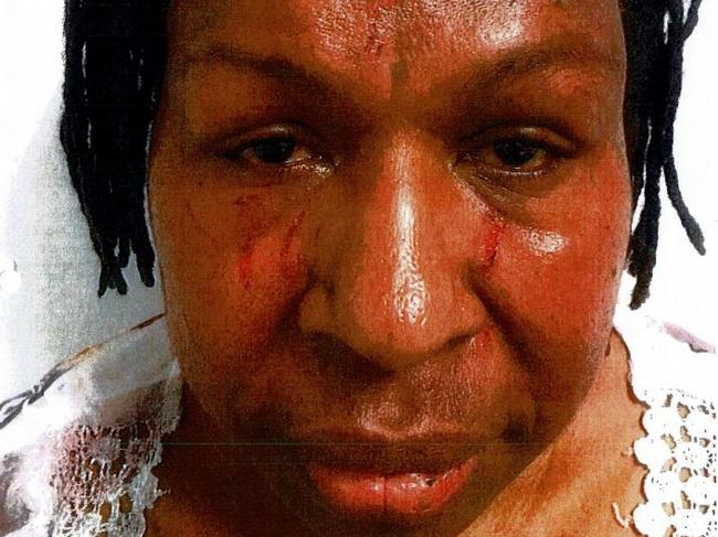 Mansis Bandi, 50, was also scratched in the face during the fight where she bit her friend’s finger off. Picture: Supplied