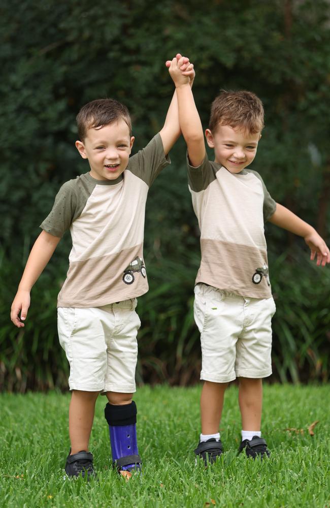 Four-year-old Gold Coast boy Lewis Porter was born with Amniotic band syndrome (ABS), but thanks to life-changing surgeries, he is able to keep up with his twin brother Ethan. Picture: Annette Dew.