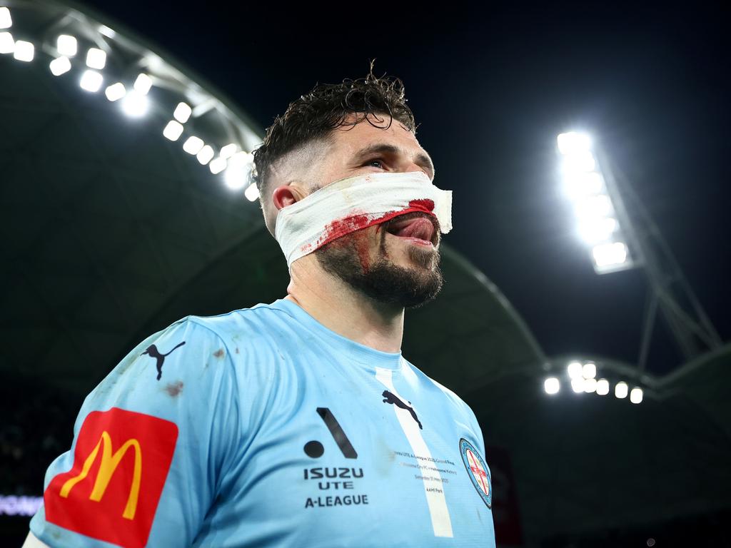 A battered Mathew Leckie is set to withdraw from the Socceroos squad after his grand final heroics. Picture: Morgan Hancock/Getty Images