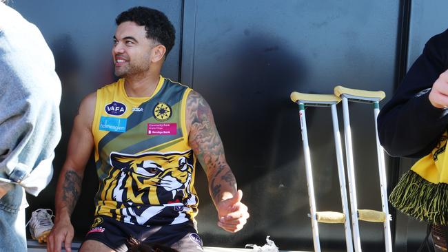 Guy Sebastian needed crutches after injurying himself. Picture: David Crosling