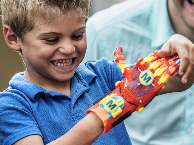 A young boy, born with a right hand malformation, tries on his new 3D-printed hand given to him by the Association for the Study and Assistance of Child Amputees (ASSEDEA) on August 17, 2015 in Cessieu. AFP PHOTO / JEFF PACHOUD