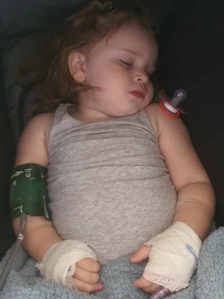 Samara the day she woke up unable to walk. Picture: Supplied by family