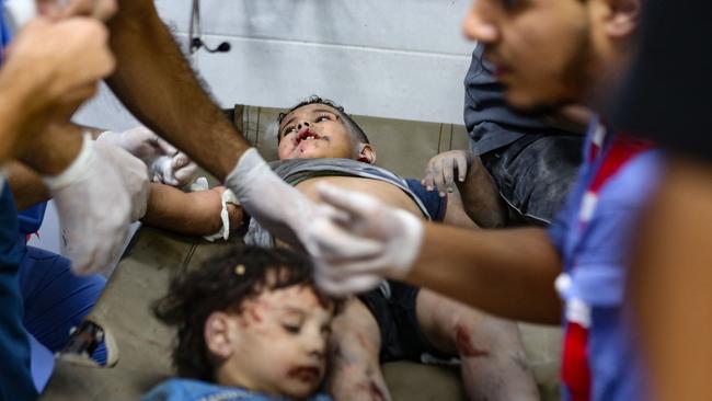 Children injured in an Israeli strike receive emergency medical care at the Al-Shifa hospital in Gaza City. Picture: Dawood NEMER/AFP