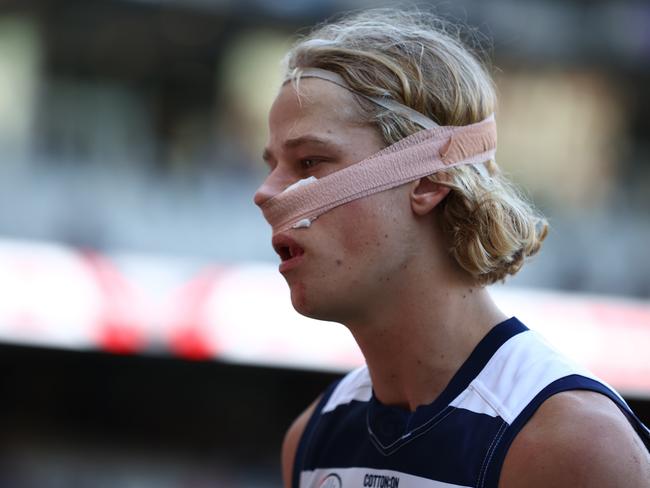 Sam De Koning copped a big blow to his face. Picture: Robert Cianflone/Getty Images