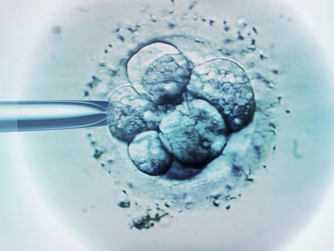 Embryo selection for IVF, light micrograph.