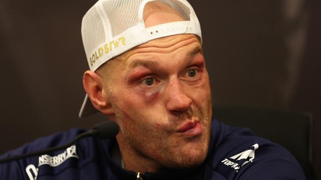 RIYADH, SAUDI ARABIA - MAY 18: Tyson Fury speaks to the media during a post fight press conference following defeat in the IBF, WBA, WBC, WBO and Undisputed Heavyweight titles' fight between Tyson Fury and Oleksandr Usyk at Kingdom Arena on May 18, 2024 in Riyadh, Saudi Arabia. (Photo by Richard Pelham/Getty Images)