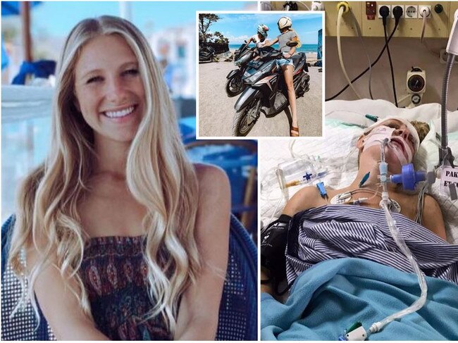 influencer's scooter crash in Bali