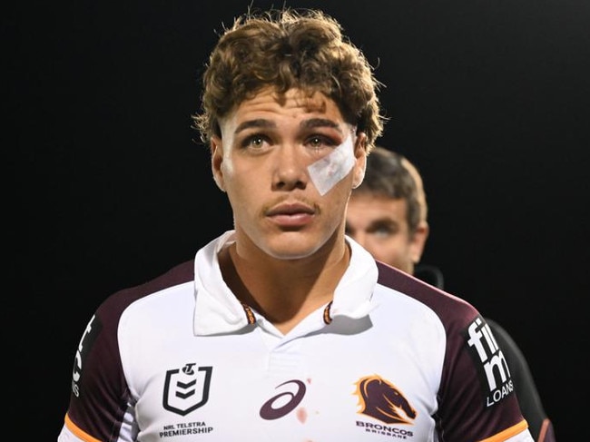 Reece Walsh suffered a facial fracture against the Panthers.