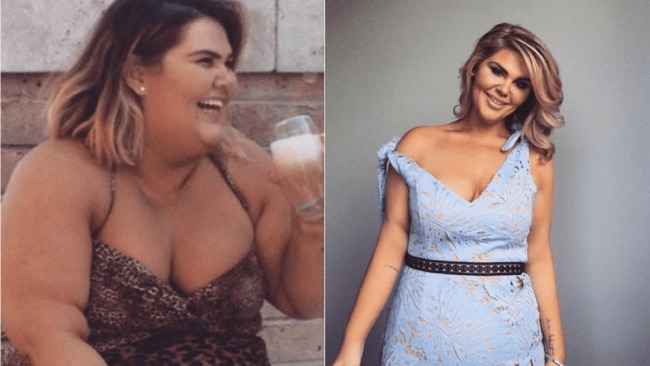 Brodie MacPherson reveals she had gastric sleeve surgery body soul