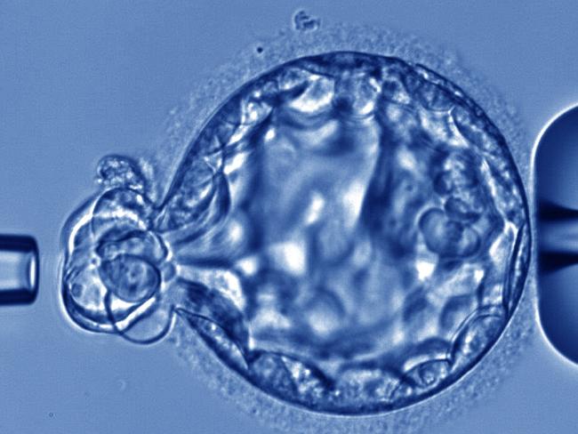 ‘Own embryo’: Horror IVF incident
