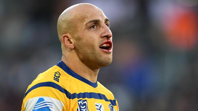 Parramatta medical staff have refused to put a time frame on when Blake Ferguson will return. Picture: AAP