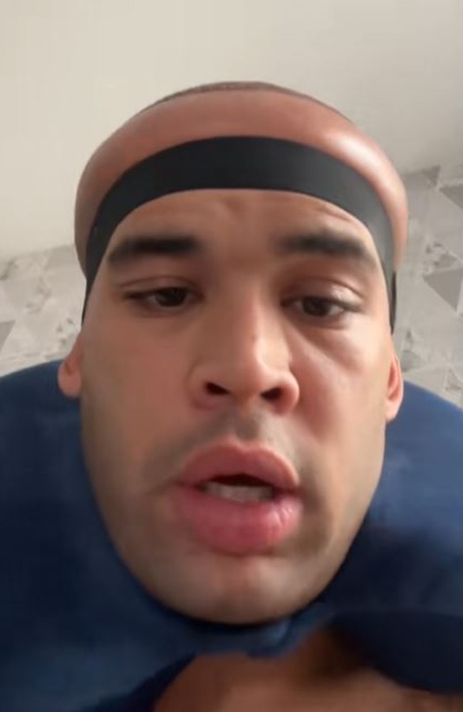 Kanah Flex got a hair transplant. Picture: TikTok/@kanahflextv