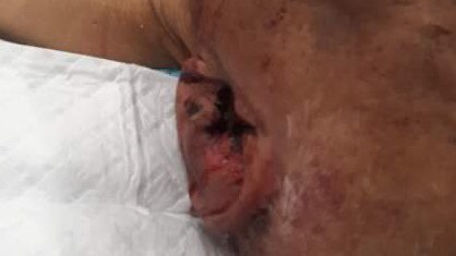 Sydney Ellis is in hospital after being savagely beaten outside Carrum Downs Plaza. Picture: Supplied