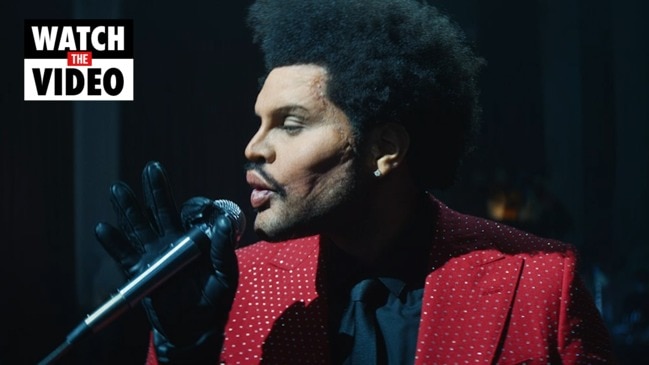 The Weeknd: Super Bowl LV performer explains face surgery stunt