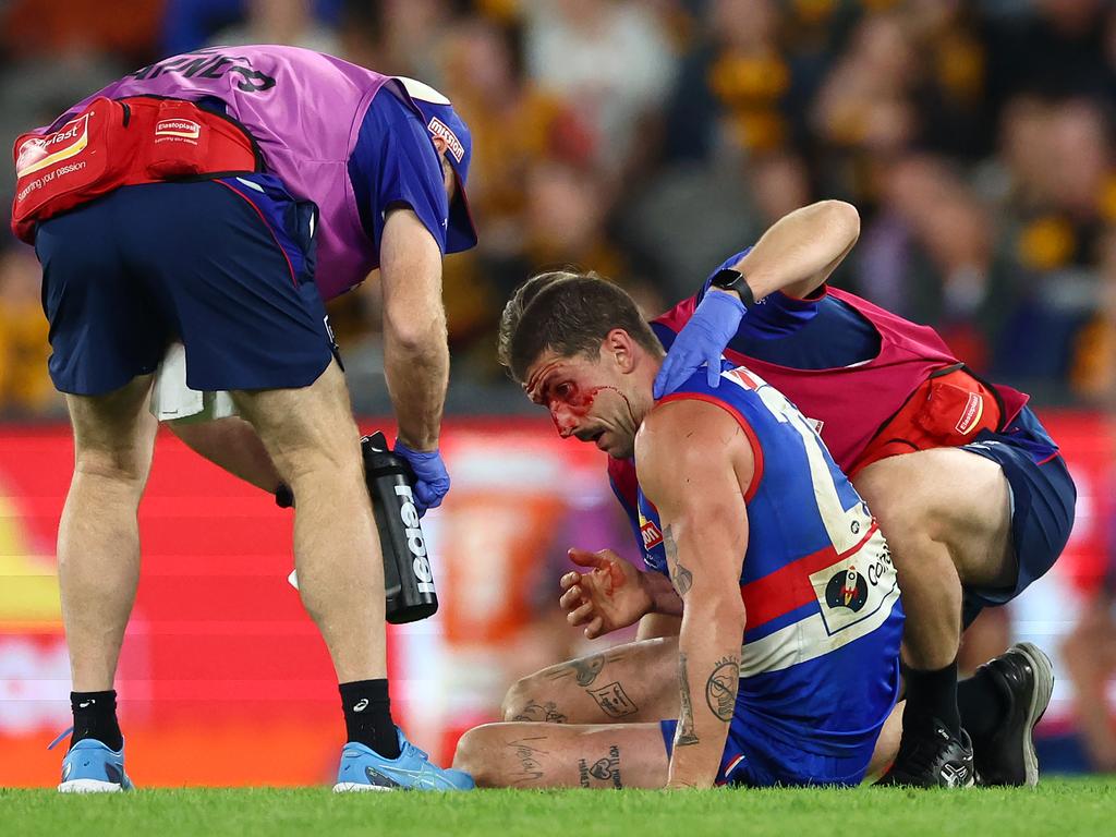 MELBOURNE, AUSTRALIA - MAY 05: Tom Liberatore of the Bulldogs is attended to by trainers during the round eight AFL match between Western Bulldogs and Hawthorn Hawks at Marvel Stadium, on May 05, 2024, in Melbourne, Australia. (Photo by Quinn Rooney/Getty Images)