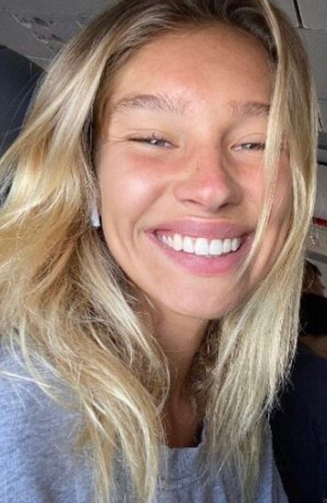 A dermatologist prescribed her on a low dose of Roaccutane and together with a balance of all five areas of her health – physical, mental, emotional, social and spiritual – it helped clear her skin. Picture: Instagram/Harmonyabell