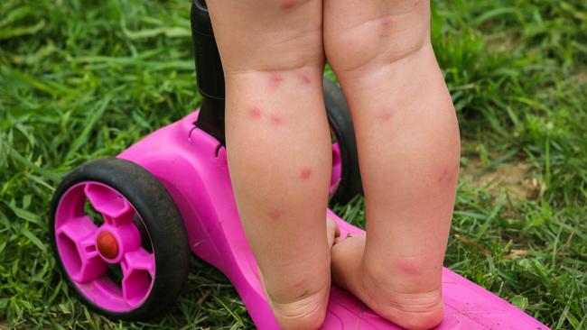 Residents have been complaining to councillors on the northern Gold Coast about a surge in numbers of mosquitoes and biting midges.