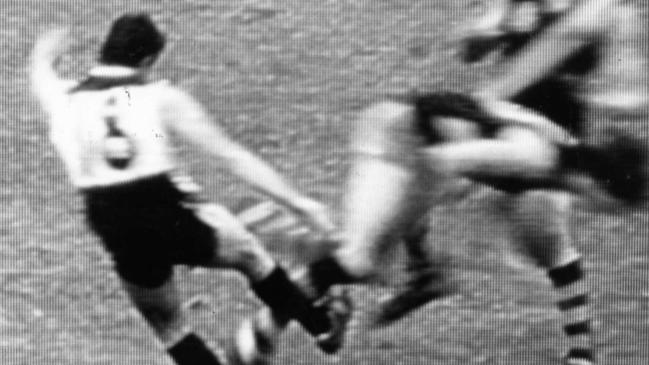 Glenelg’s Stephen Barratt had his leg broken when kicked by David Granger.