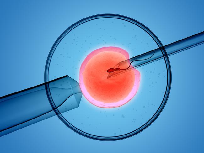 3D rendering of the icsi(intracytoplasmic sperm injection) process - in which a single sperm is injected directly into an egg  Picture: Istock