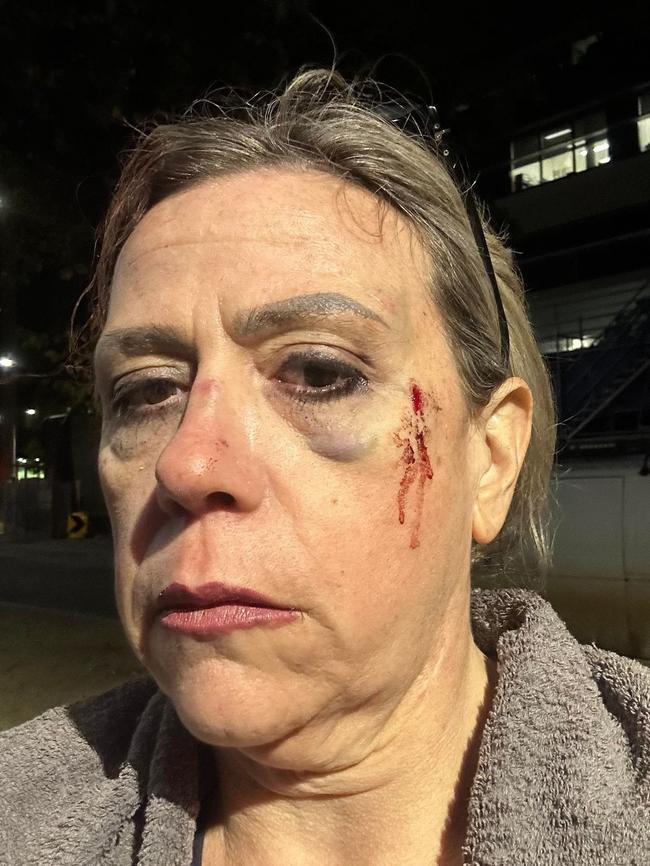 Caitlin Morrison, 45, was assaulted on a Melbourne tram on April 22. Picture: Supplied