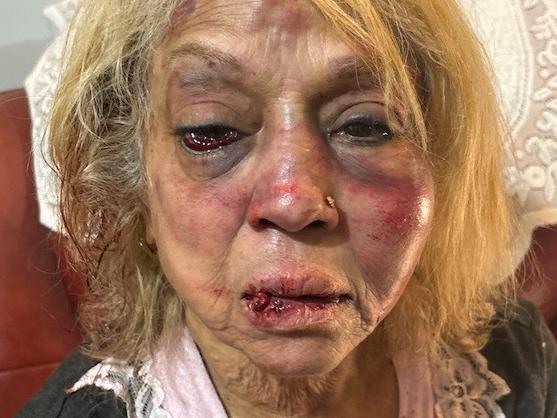 Ninette Simons was the victim of a brutal home invasion and bashing allegedly committed by three men, including one of the detainees released by the High Court late last year.