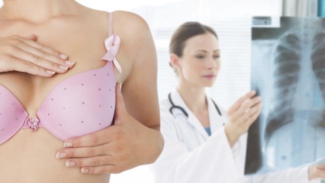 Self-breast examination and imaging screening are two musts when it comes to preventing breast cancer. Picture: iStock