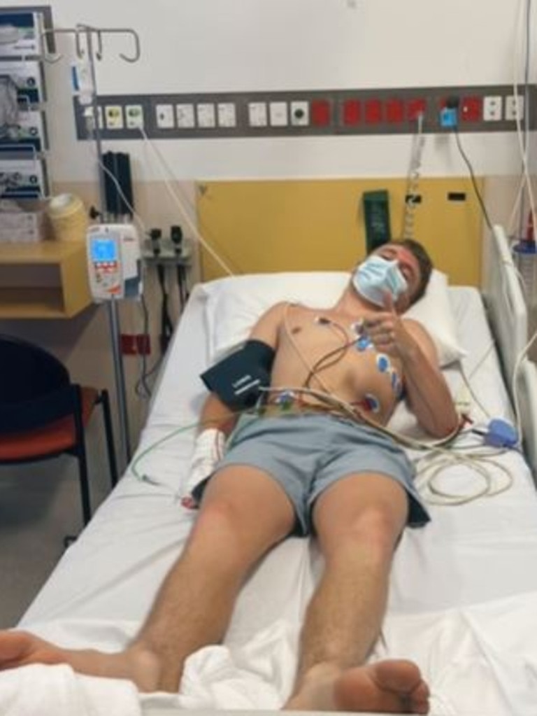 Pictured is a British tourist who got stung by an Irukandji at Palm Cove Beach in Far North Queensland. Picture: TikTok/storyofsavannah