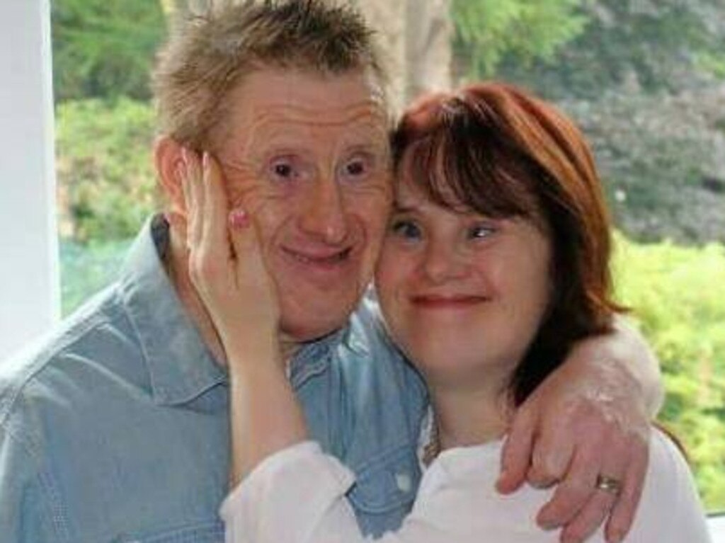 Как сейчас выглядит дарина с синдромом нагера Britain’s first married Down’s syndrome couple face separation news.com.au - Aus