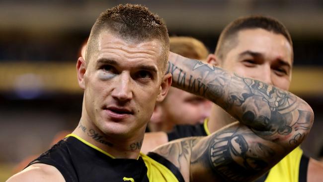 Dustin Martin has suffered a fractured cheekbone. (Photo by Robert Cianflone/Getty Images)